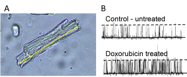 Image of a Representative trace illustrating single cell cardiomyocyte contractility